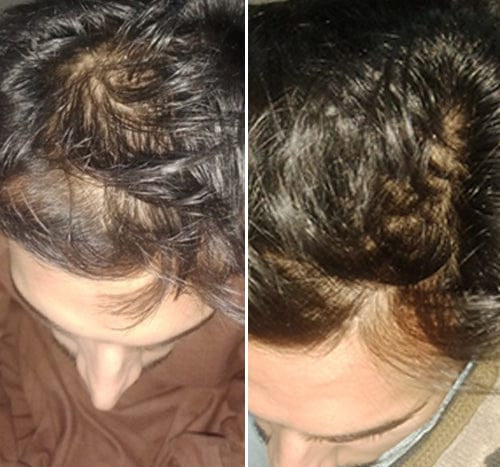 Before and after comparison of a person's hair styled in braids.